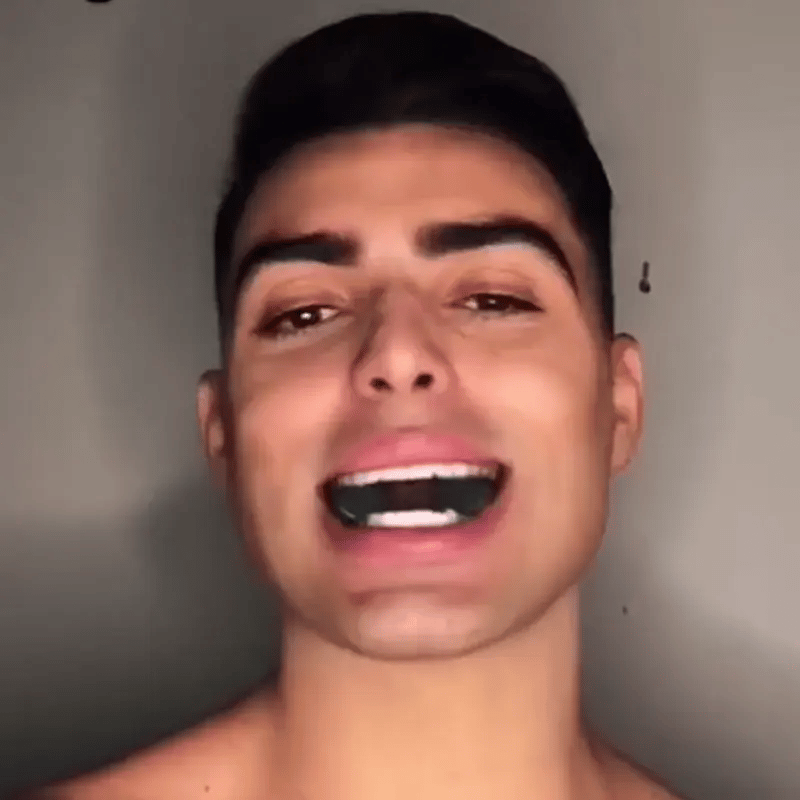 Ejercitador de mandíbula