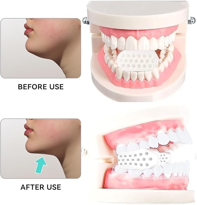 Ejercitador de mandíbula